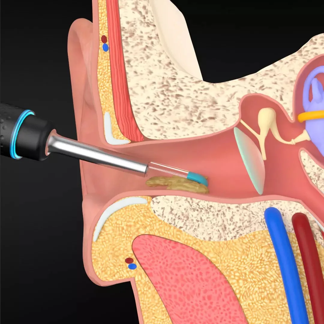 XIAOMI MIJIA Inteligentni visual uho pobral palico 300W visoko precizne endoskop z 350mAH magnetni polnjenje baze