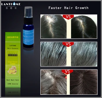 Lanthome hitro andrea rast las, Izdelki za lase sprej bistvu anti padec las zdravljenja laser rast dlak za ženske in moške