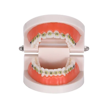 Zobni Ortodontskega model Ortodontskega model Zobne Nosilec Zob model