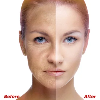 2/10/30 kos QYANF Serum za obraz za nego kože Colageno hidroliziran kolagen pomlajevanje proti gubam anti-aging