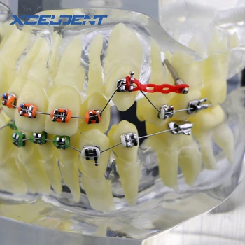 1Pcs Ortodontsko Zdravljenje zob Malocclusion Model W/ Oklepajih Verige Žice #3005-3 Zobni Laboratorij Zobne Zob Modeli