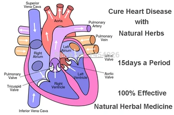 Bolezni srca Medicine Naravnih Rastlin, Zdravljenje Bolezni Srca po Tradicionalni Kitajski Medicini Zeliščne Terapije