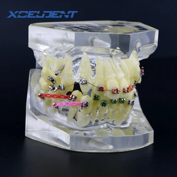 1Pcs Ortodontsko Zdravljenje zob Malocclusion Model W/ Oklepajih Verige Žice #3005-3 Zobni Laboratorij Zobne Zob Modeli