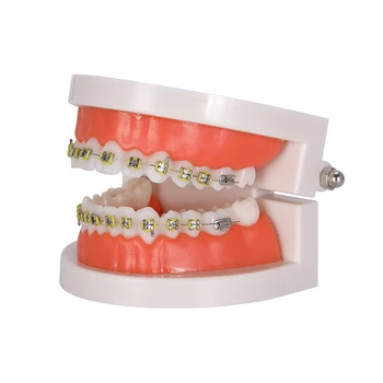 Zobni Ortodontskega model Ortodontskega model Zobne Nosilec Zob model