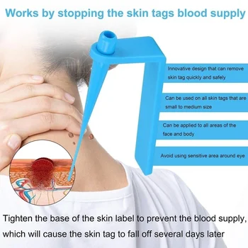 1 Nastavite Sumifun Oznako Mol Wart Odstranjevalec Mikro Kože, Odstranjevalec Komplet Za Domačo Uporabo, Telo Učinkovito Nego Kože C1769